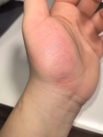 又一次回购